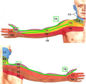 raumenų skausmas ir sąnarių kairės rankos