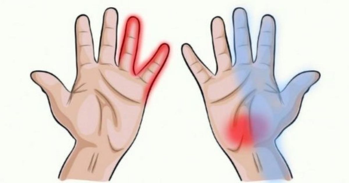ligos nuo pirštų kairės rankos sąnarių stuburo kremzles trukimas