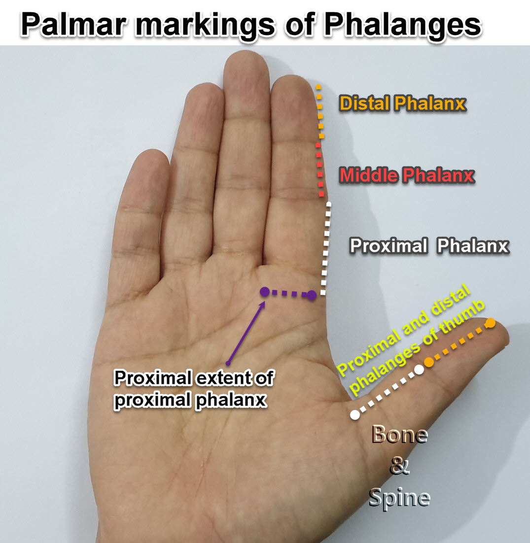 artritas phalanx finger skauda bendrą dubenį į kairę