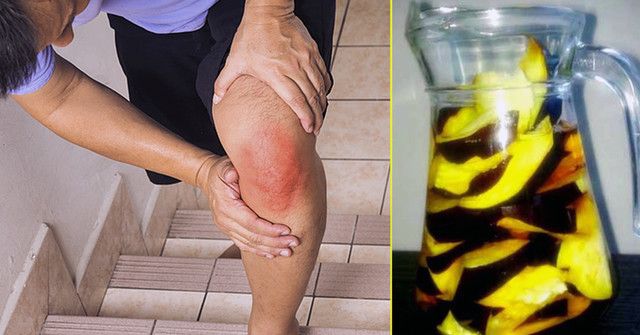 reumatoidinis artritas liaudies medicina sustav lotynų liga