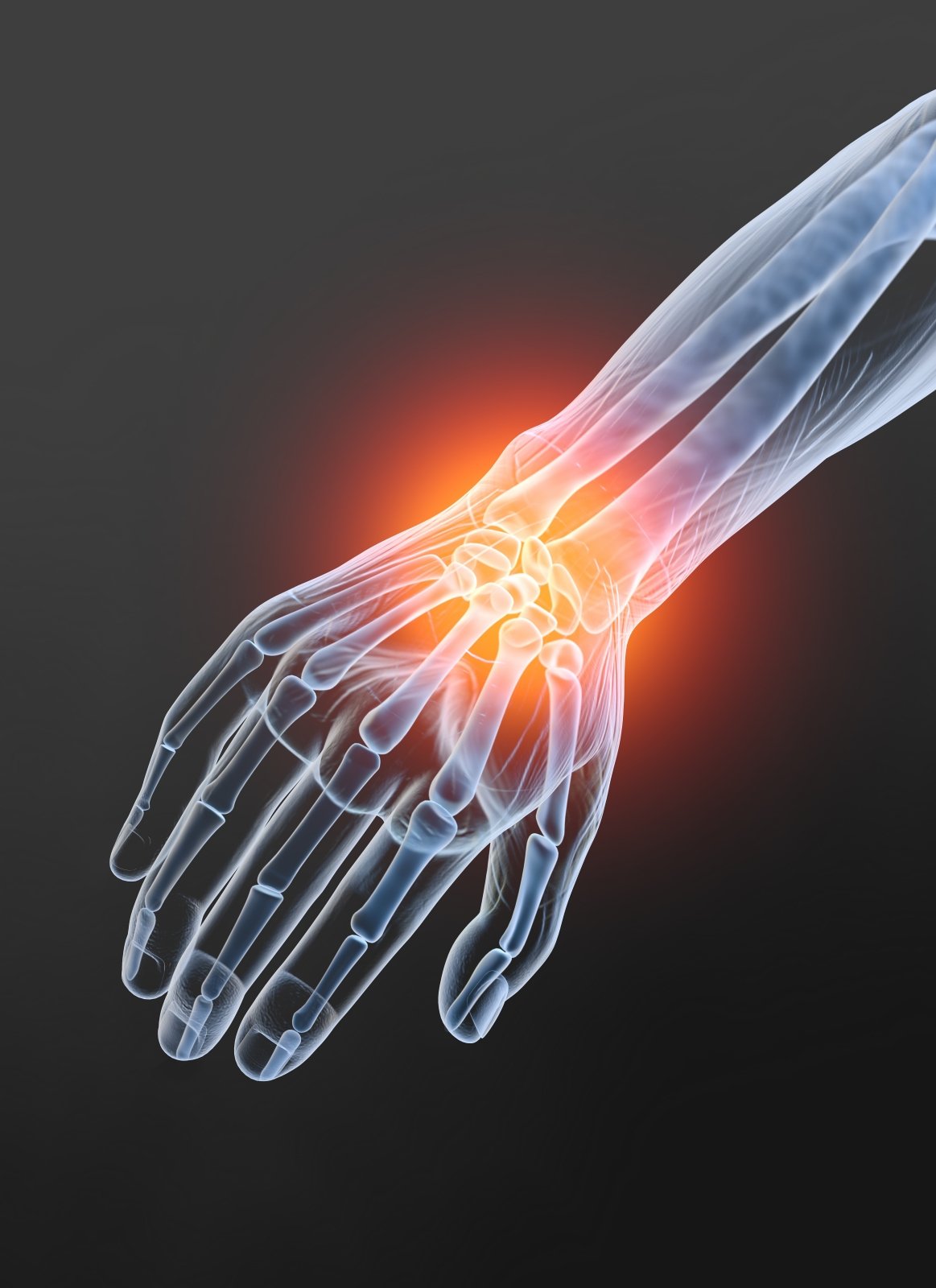 reumatoidinis artritas liaudies medicina šviesos sąnarių ligos