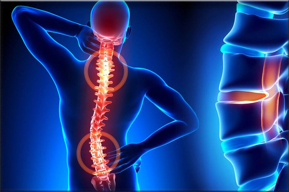 gydymas nugaros skausmas į ryšulius ir sąnarių skausmui gydyti veikimo metu