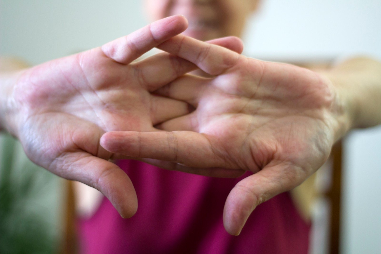 skausmas į apsinuodijimo maistu sąnarių artritas rankų ir pečių