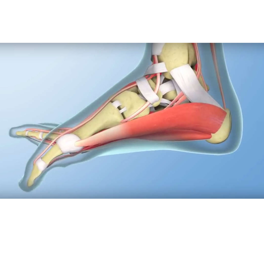 skauda pėdos pėdos priemonė regeneruoti kremzlės sąnarių