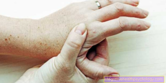 po miego sąnariai skauda ant rankų medicina geliai osteochondrozės metu