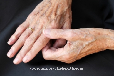 sąnarių liga osteoartrito pirštais rankas