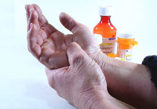 gydymas artrozės rankų