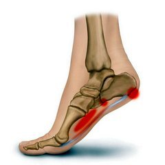 kaip atsikratyti skausmo pėdos sąnarių
