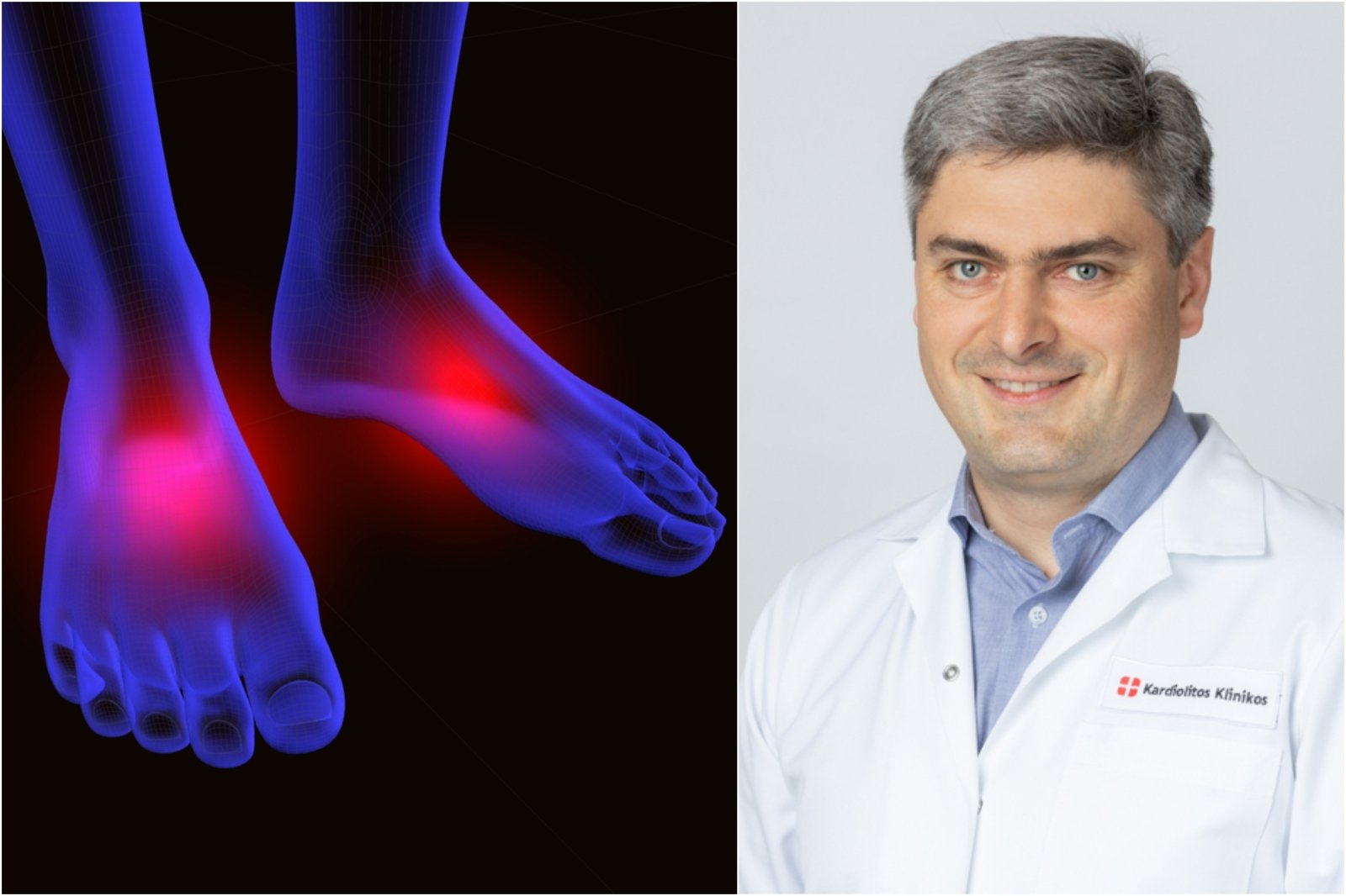 kaip atsikratyti skausmo pėdos sąnarių mazi už artrozės peties sąnario gydymo
