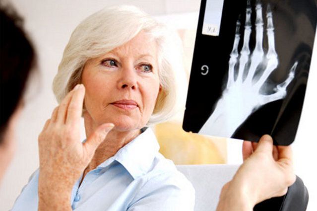 artrozė bendros šepečiu liga artritas artrito formų sąnarių gydymas