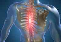 kremas nuo osteochondrozės geli nuo raumenų skausmas sąnariuose