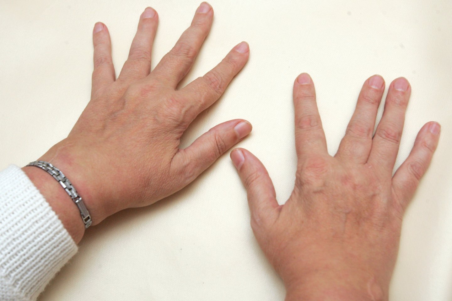 medicina liga sąnariai artritas išlaikyti jaws