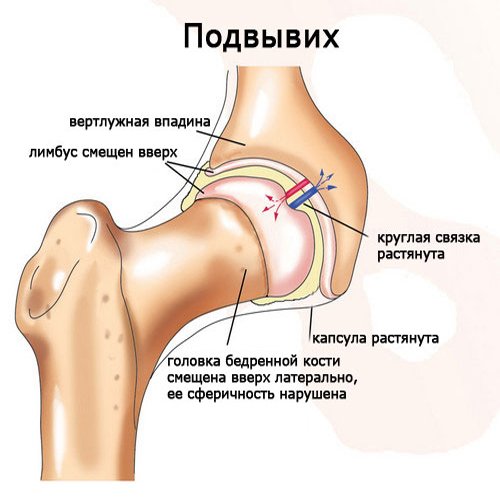 priemonė sąnarių ir ryšulius ant artritas iš snukio ženklų sąnarių
