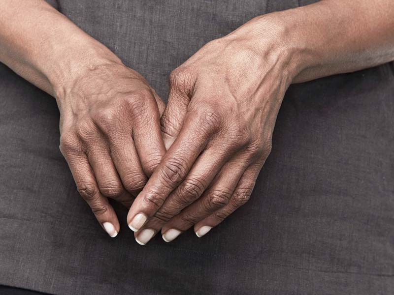 artritas šepetys rankoms ir jos gydymas