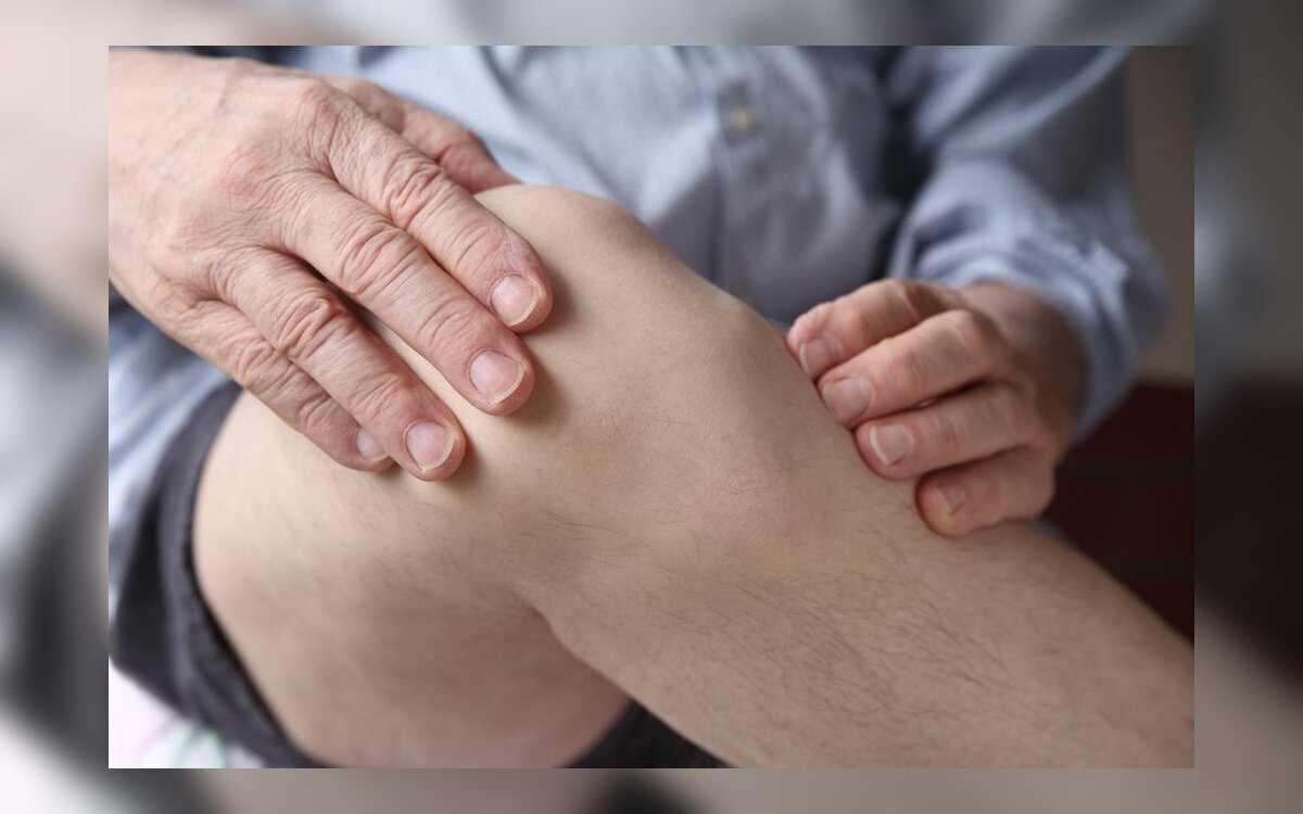 kas yra artrozė kojų ir gydymas