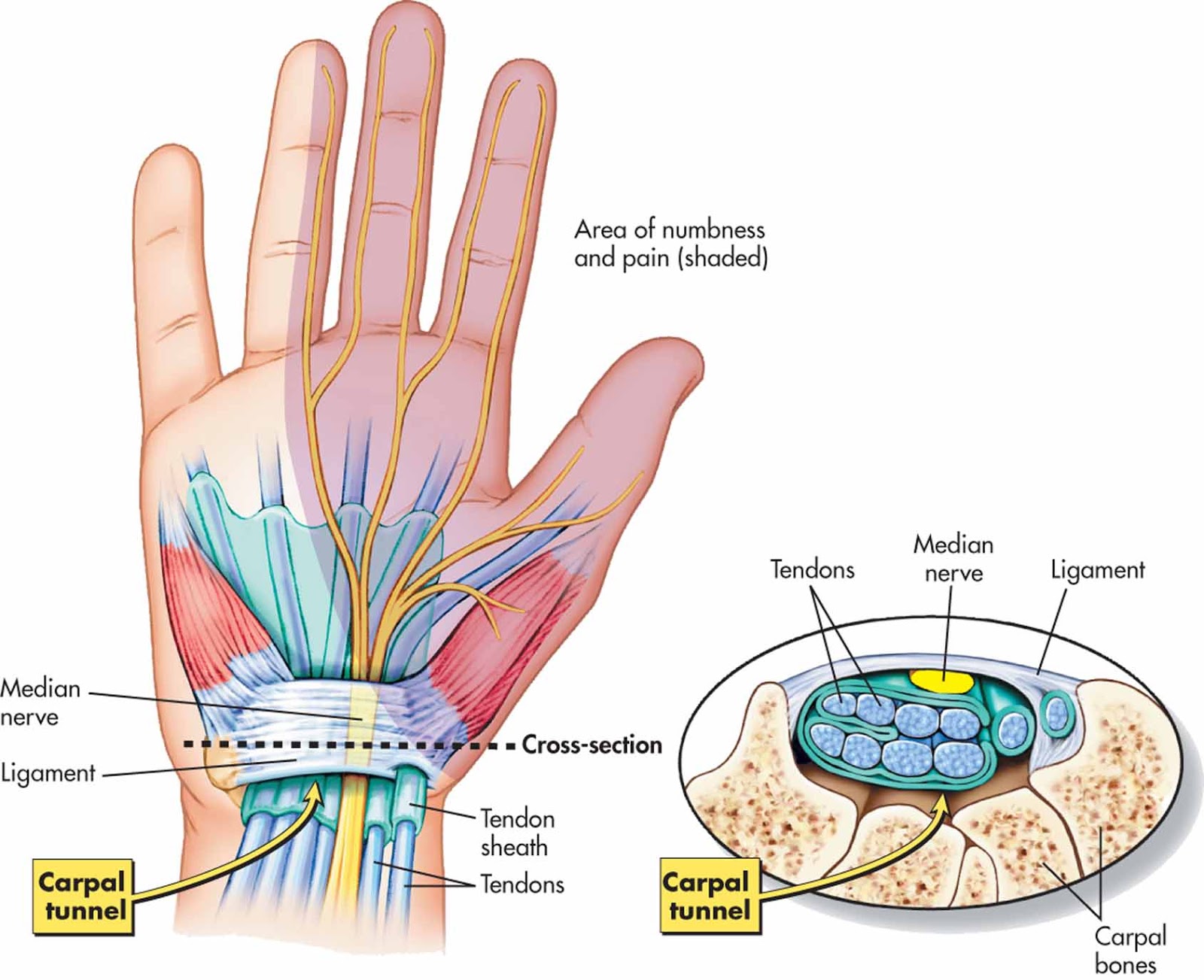 artrozė riešo gydymas gydymas artrozės ir osteoartrozės