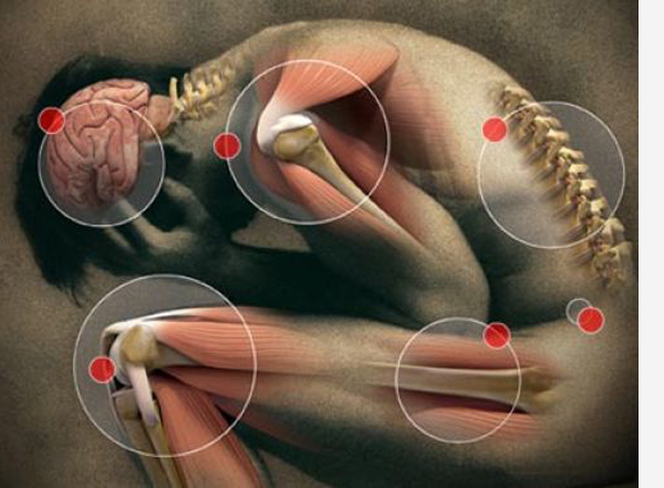 blokados su skausmų į pasekmes sąnarių alkūnė sąnariai skauda raumenis