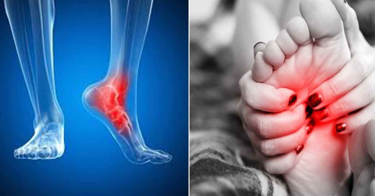 koju pėdų skausmas deginimas gydyti skausmo gydymui