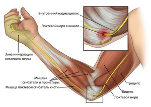 skausmas alkūnės sąnario dešinės rankos kai plėtinys gliukozamino chondroitino japonija atsiliepimai