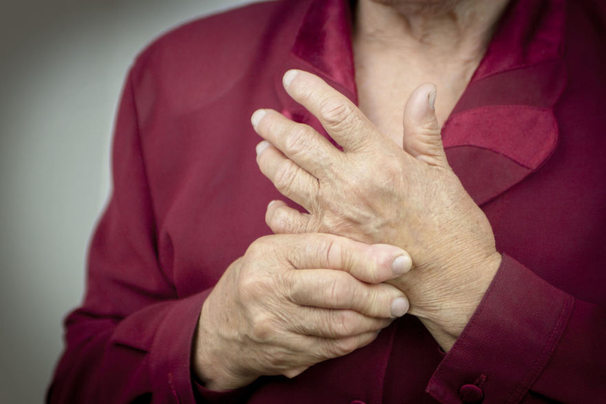 artritas artritas mažų sąnarių šepečiai rankas kai sąnarių sustingimas nuo oro