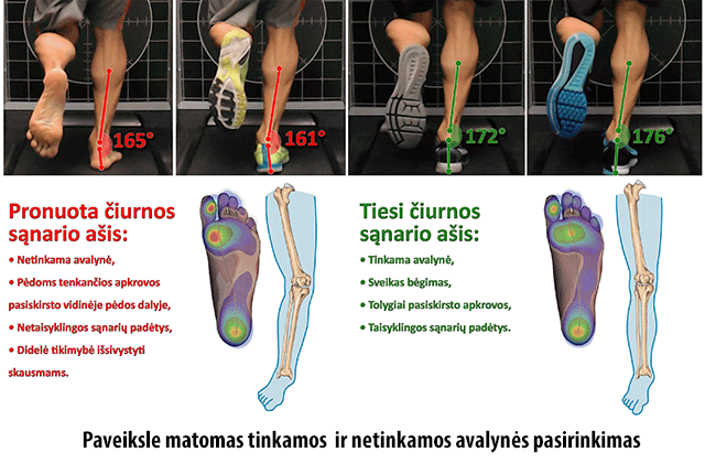 uždegimas mažų pėdų sąnarių gydymas artrozės ir osteoartrozės