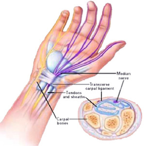gerklės riešo sąnarių ant rankos priežastis faberlik gliukozaminas ir chondroitino
