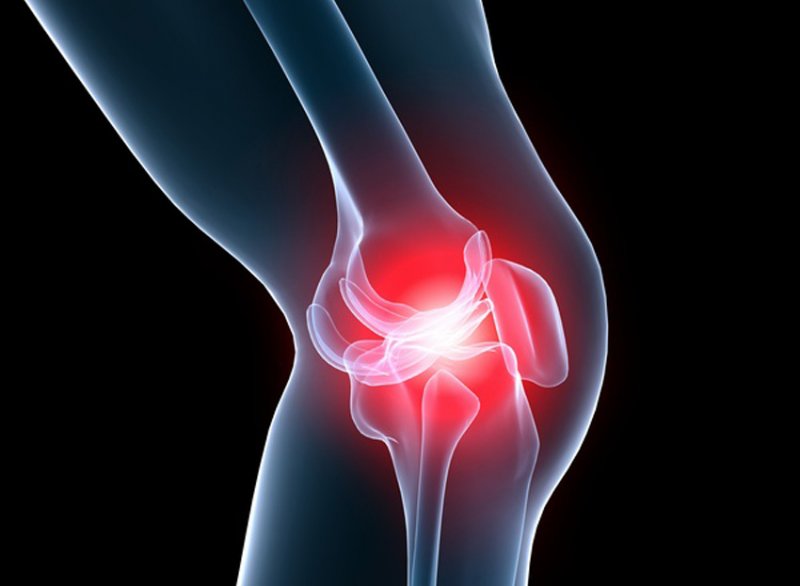 kas yra gydomi artrozė kojų sąnarių skausmas kai nuspaudžiamas