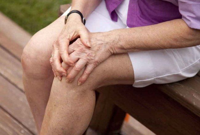 liaudies metodai gydant sąnarių sąnarius artrozė rankų 1 laipsnis gydymas