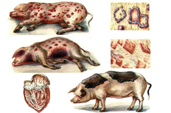 ligos sąnarių kiaules gerklės pečių sąnarių moterimi