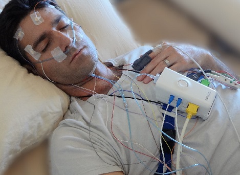 miego liga gydymas spurgų ant balandžių sąnarių