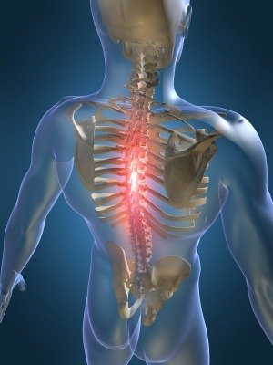 osteochondrozė iš raumenų sąnarių ligų kaip pašalinti skausmą bendrą greitai