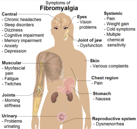 pagrindinė skausmas fibromialgija