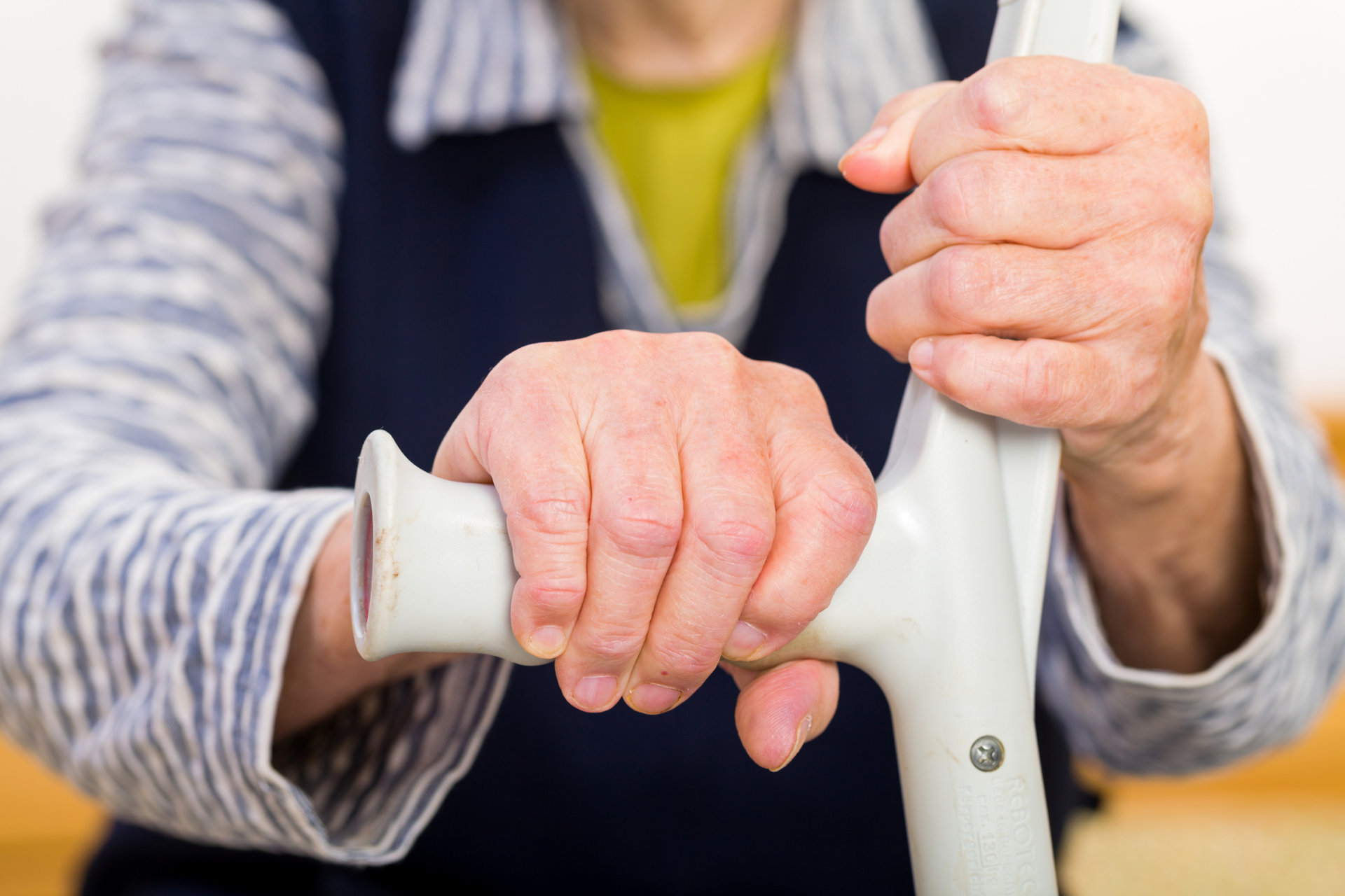 reumatoidinis artritas ranka gydymą liaudies gynimo gerklės riešo sąnarių ant rankos ką daryti