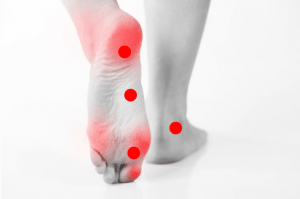 skausmas pėdos priežasčių pėdos