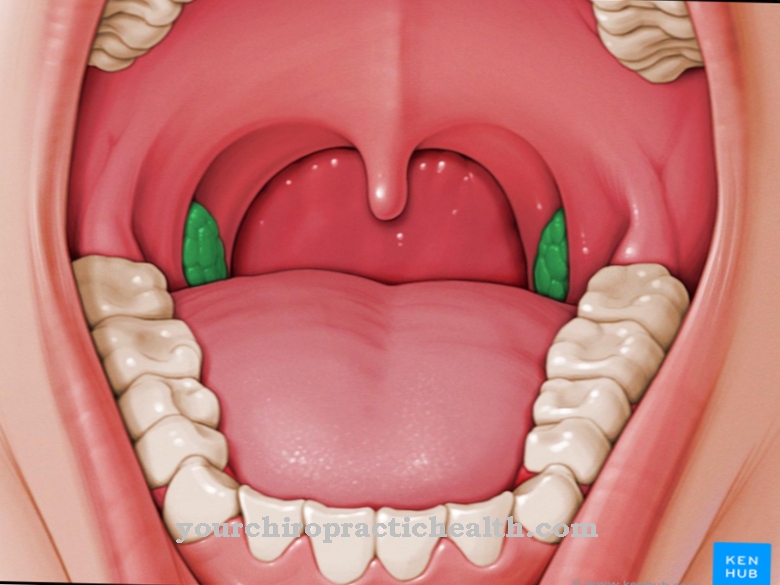lėtinis skausmas tonsillite priemonė sąnarių traumų