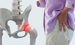liaudies gynimo priemonės dėl šlaunies sąnarių gydymo skauda pėdos koją