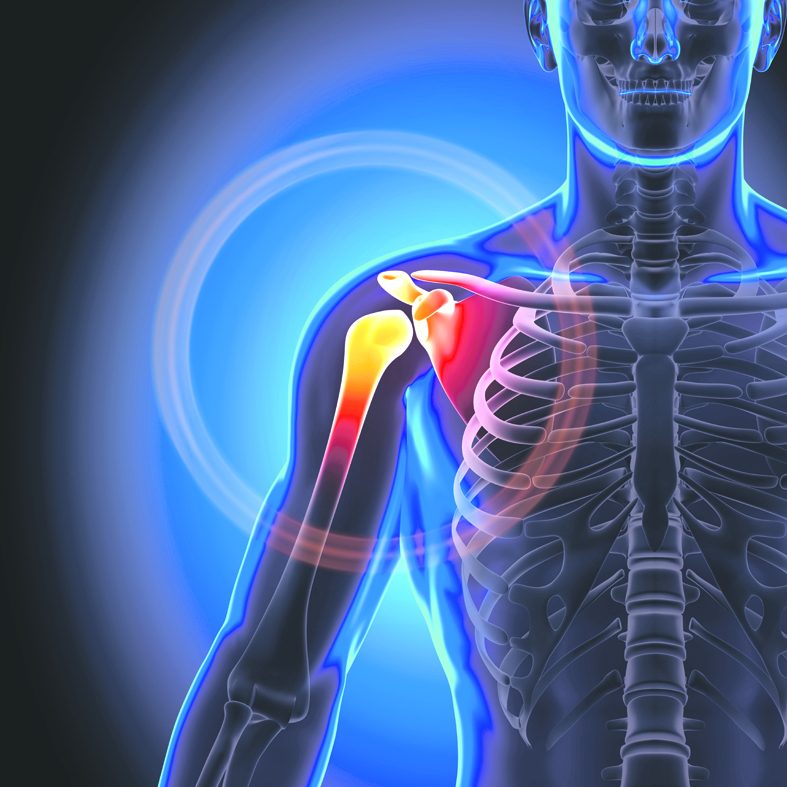 gydymas raumenų sąnarių susieti eilutę nuo skausmo riešo sąnarių