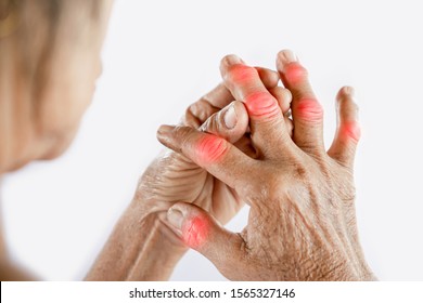 swelling joints painful