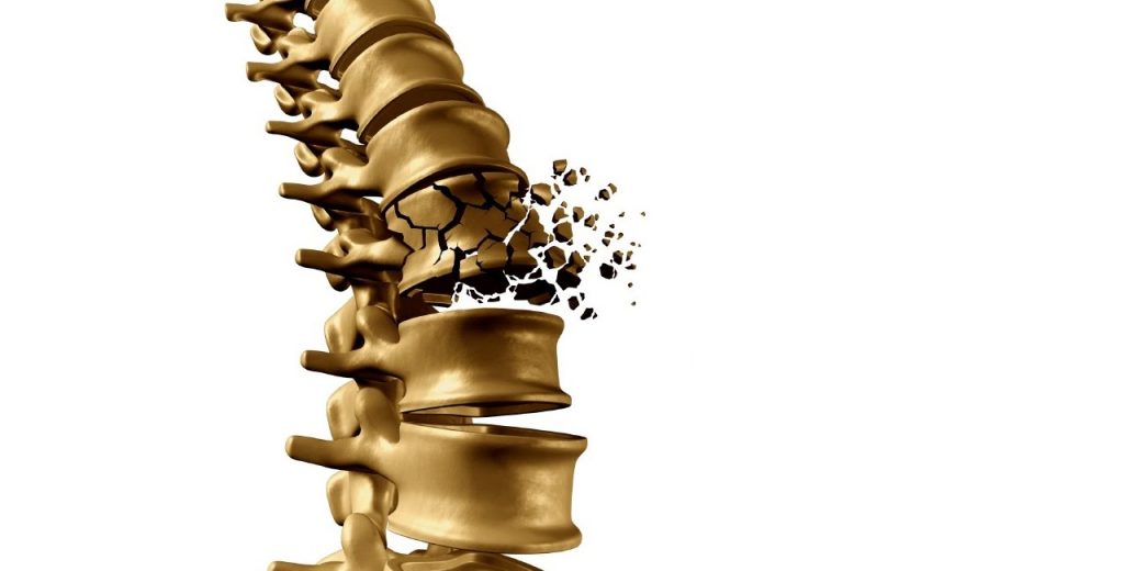 nugaros osteochondrozė suskirstytas sąnarių skausmas