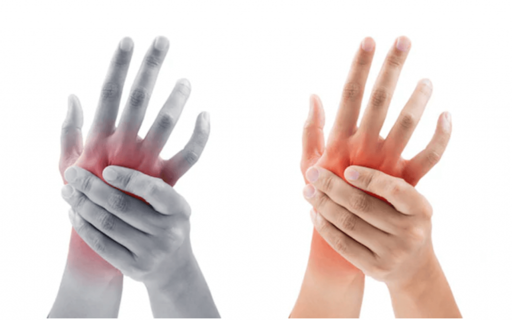 sirdies skausmas ir rankos tirpimas dugootroschatye sąnarių artrozės