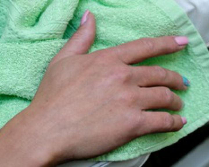 skauda sąnarį ant viduriniojo piršto dešinės rankos artritas artrozė jų gydymas