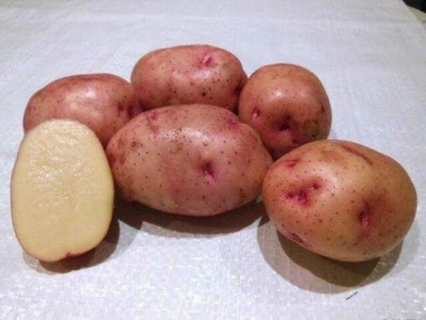 bulvių iš bendrų ligų artrozė žandikauliai gydymas