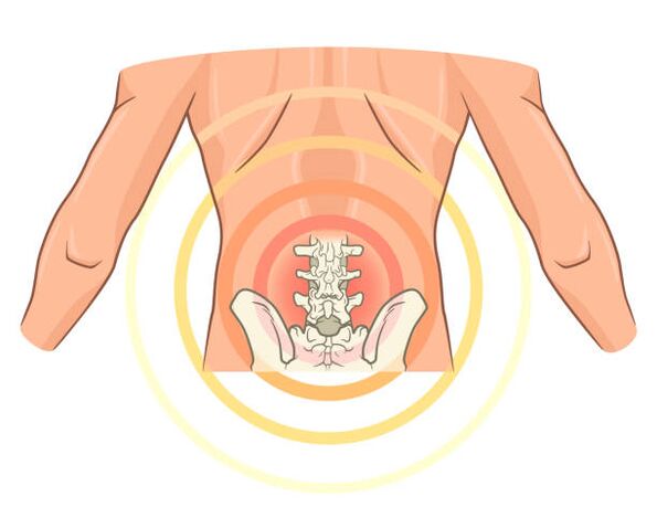 mazi už nugaros osteochondrozė gydymas sustav cheeky