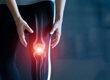 osteoartrito periferinių sąnarių gydymas