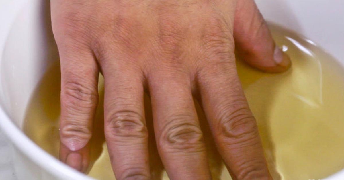swollen painful finger joints pregnancy
